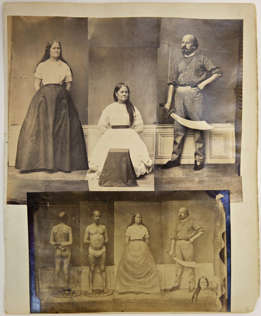 Obsession untitled, ca. 1870 collage, photography, mixed media, 29 x 24 cm Courtesy Delmes & Zander, Berlin + Cologne